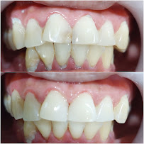 Uluwatu Dental Care