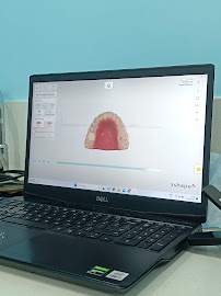 Toothsi by MakeO | Invisible Braces & Aligners | Nungambakkam