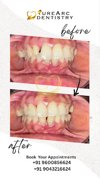 PureArc Dentistry (Invisalign chennai, Braces, Root canal, Dental clinic ashok nagar, Dental clinic near me, Dentist near me)