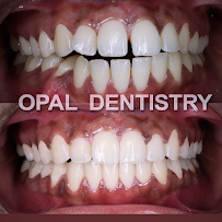 Opal Dentistry | Invisalign Provider