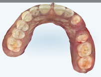Sirpi Dental Clinic / 200ft Radial Road –Best Invisalign Expert in South Chennai - Best Dental Implant Expert