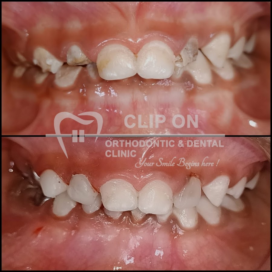 Clip On Dental dental clinic