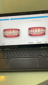 CLIP ON Dental | Orthodontist | Invisalign | Braces | Implants | Anna nagar