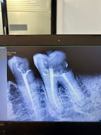 CLIP ON Dental | Orthodontist | Invisalign | Braces | Implants | Anna nagar