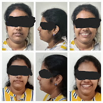 smiles orthodontic and implant centre