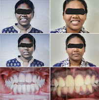 smiles orthodontic and implant centre