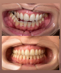 Doç.Dr.Halise Aydemir – İzmir Ortodonti Uzmanı (Folkart Towers)Ortognatik Cerrahi.Şeffaf plak(İnvisalign). Dijital Ortodonti