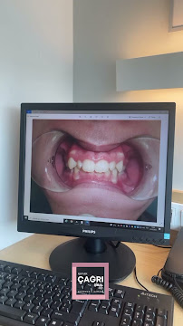 Ortodonti Uzmanı Çağrı Şibal - Ortodontik Tedavi I İzmir Şeffaf Plak I invisalign