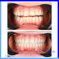 Ortodonti Uzmanı Çağrı Şibal - Ortodontik Tedavi I İzmir Şeffaf Plak I invisalign