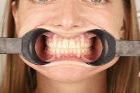 Ortodonti Uzmanı Çağrı Şibal - Ortodontik Tedavi I İzmir Şeffaf Plak I invisalign