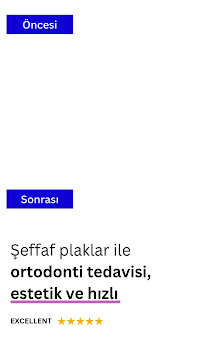 Ortodonti Uzmanı Çağrı Şibal - Ortodontik Tedavi I İzmir Şeffaf Plak I invisalign