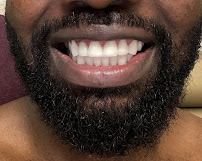 Prof Clinic | Dental Clinic Turkey