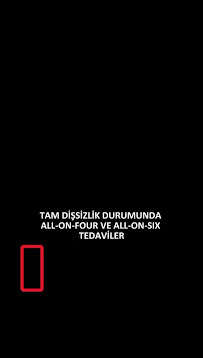 Özel DentaPoint Diş Polikliniği Bostanlı Şubesi - İmplant , Zirkonyum , Estetik Diş , Acil Diş , Kanal Tedavisi