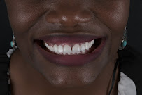 Prime Dental Turkey