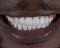 Prime Dental Turkey