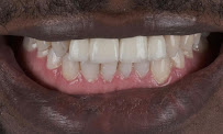 Prime Dental Turkey in Izmir