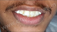 (new site ) Best Laser Dental Clinic and Implant Centre