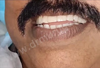 (new site ) Best Laser Dental Clinic and Implant Centre