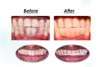 Chinthamani superspeciality dental implant centre