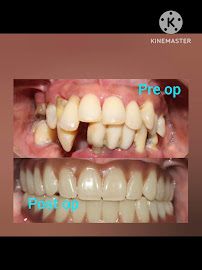Chinthamani superspeciality dental implant centre