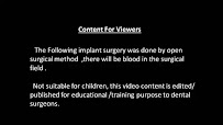 Chinthamani superspeciality dental implant centre