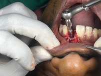 IMPLANT CASTLE — Dental Clinic |AIIMS Dentists | | Best Dental Clinic Perambur Chennai| RCT,Invisalign, Implant specialist