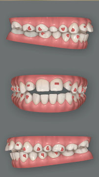 ROOTZ DENTAL CARE AND IMPLANT CENTER