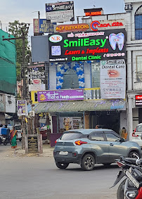 SmilEasy® Lasers & Implants Dental Clinic, Pallavaram | PAINLESS FULL MOUTH IMPLANTS | INVISIBLE ALIGNERS | LASER ROOT CANAL