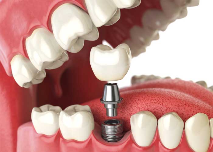 Precigem Dental World dental clinic