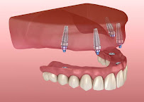 Precigem Dental World