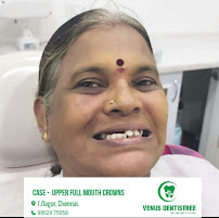Venus Dentistree - Best Dental Aligners | Best Dental Implants