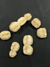 AKEELA DENTAL CARE - ADVANCED DENTAL IMPLANT CLINIC AND COMPLETE TEETH SET IN CHENNAI, BEST DENTAL IMPLANTS IN CHENNAI