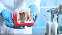 AKEELA DENTAL CARE - ADVANCED DENTAL IMPLANT CLINIC AND COMPLETE TEETH SET IN CHENNAI, BEST DENTAL IMPLANTS IN CHENNAI