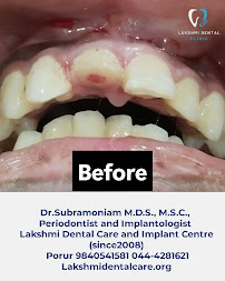 Lakshmi Dental care and implant centre ( estd 2008)