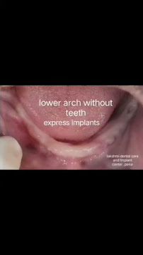 Lakshmi Dental care and implant centre ( estd 2008)
