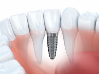 Expert Dental Care