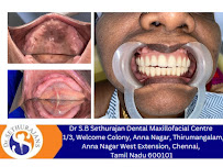 Sethu Dental | Dr Sethurajan Dental & Maxillofacial & Implant Center, Anna Nagar