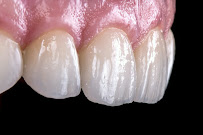 Smile Orchid Dental Chennai/ Invisalign Centre / Braces / Implants / Smile Makeover Clinic / Orthodontist / Prosthodontist