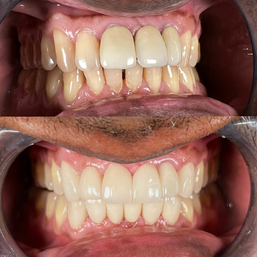 Gloss Dental Multispeciality Perambur dental clinic