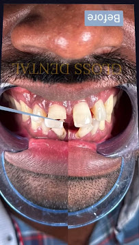 Gloss Dental Multispeciality Perambur