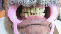 Tooth Craft Multispeciality-Best dentist in Ashoknager- Invisalign, Implants,Braces,Veneers,Rootcanal