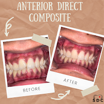 (SDC) Shine Dental Care Bali