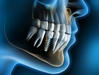 Impressions Dental, Cosmetic & Hair clinic