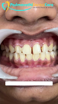 Padmavathi Dental Care | Invisalign Clinic | Porur