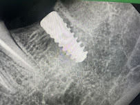 Dr D's Dentistry - Best Dental Clinic in Royapettah, Chennai