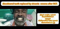 Dr.Sangeetha's Dental Clinic, Implant centre, orthodontic centre, pedodontic centre, Endodontic centre, oral surgery, X-ray
