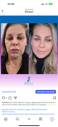 JFS Clinic – Plastic Surgery & Dental Treatment Izmir, Turkey