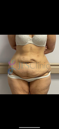 JFS Clinic – Plastic Surgery & Dental Treatment Izmir, Turkey