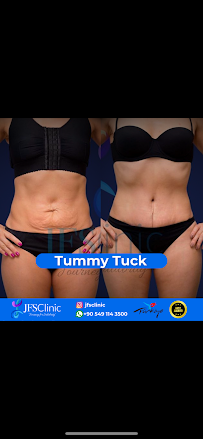 JFS Clinic – Plastic Surgery & Dental Treatment Izmir, Turkey
