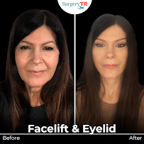 Surgery TR - Plastic Surgery & Hair Transplantation & Cosmetic Dentistry (Head Office)